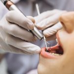 Envelhecimento dos dentes: Entenda por que acontece e quais são os sinais